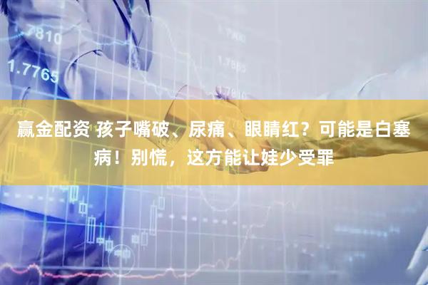 赢金配资 孩子嘴破、尿痛、眼睛红？可能是白塞病！别慌，这方能让娃少受罪